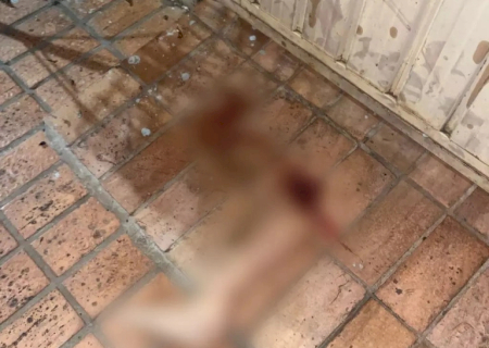 Mulher é atropelada e perna da vítima é encontrada a 50 metros do local do acidente