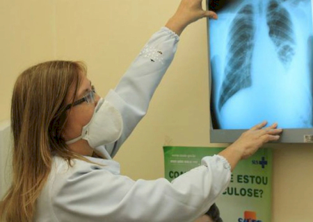 Prefeitura capacita equipes de saúde após aumento de casos de tuberculose em Dourados